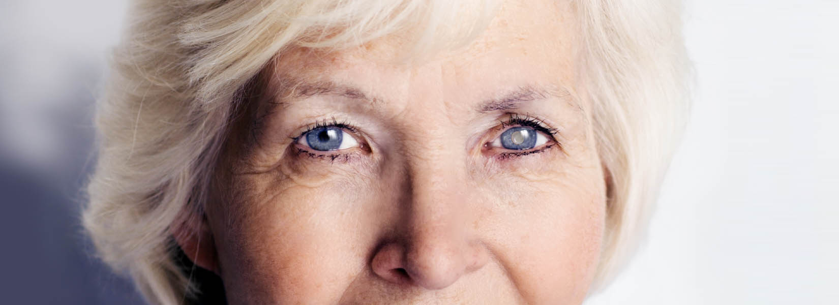 Cataract Surgery in Woodbury